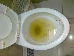 Cara Mengatasi Wc Mampet Tanpa Sedot Cara Mengatasi Wc Mampet