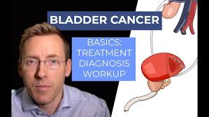Prostate Cancer Treatments with Dr. Daniel Belew