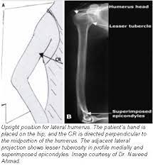 Boning Up On Humerus Clavicle And Ac Joint Positioning Diagnostic Imaging Radiology Nuclear Medicine