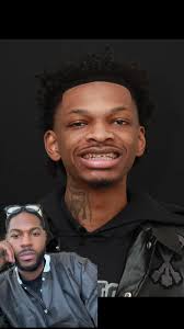 Life Changing! Porcelain Veneers 🦷💫