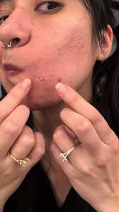 Effective Techniques for Whitehead Extractions