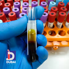 Image result for Serum Folate