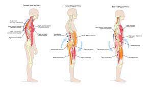 The piriformis muscle contributes to pain in the low back, buttocks, hip, and hip joint, pelvic area, and pain down the back of the thigh. Muscles That Cause The Most Back Pain And How To Get Relief Tender Touch Therapies