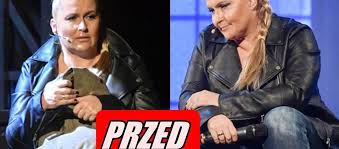 Zobacz najciekawsze publikacje na temat: Katarzyna Skrzynecka Mocno Schudla Juz Tak Nie Wyglada Jej Najnowsze Zdjecia Powalaja Super Express Wiadomosci Polityka Sport