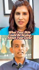 Is your skin trying to tell you something? 🤔 , Fatty liver can show early  signs