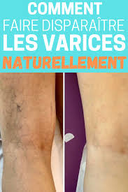 Epingle Sur Astuces Pour Elle