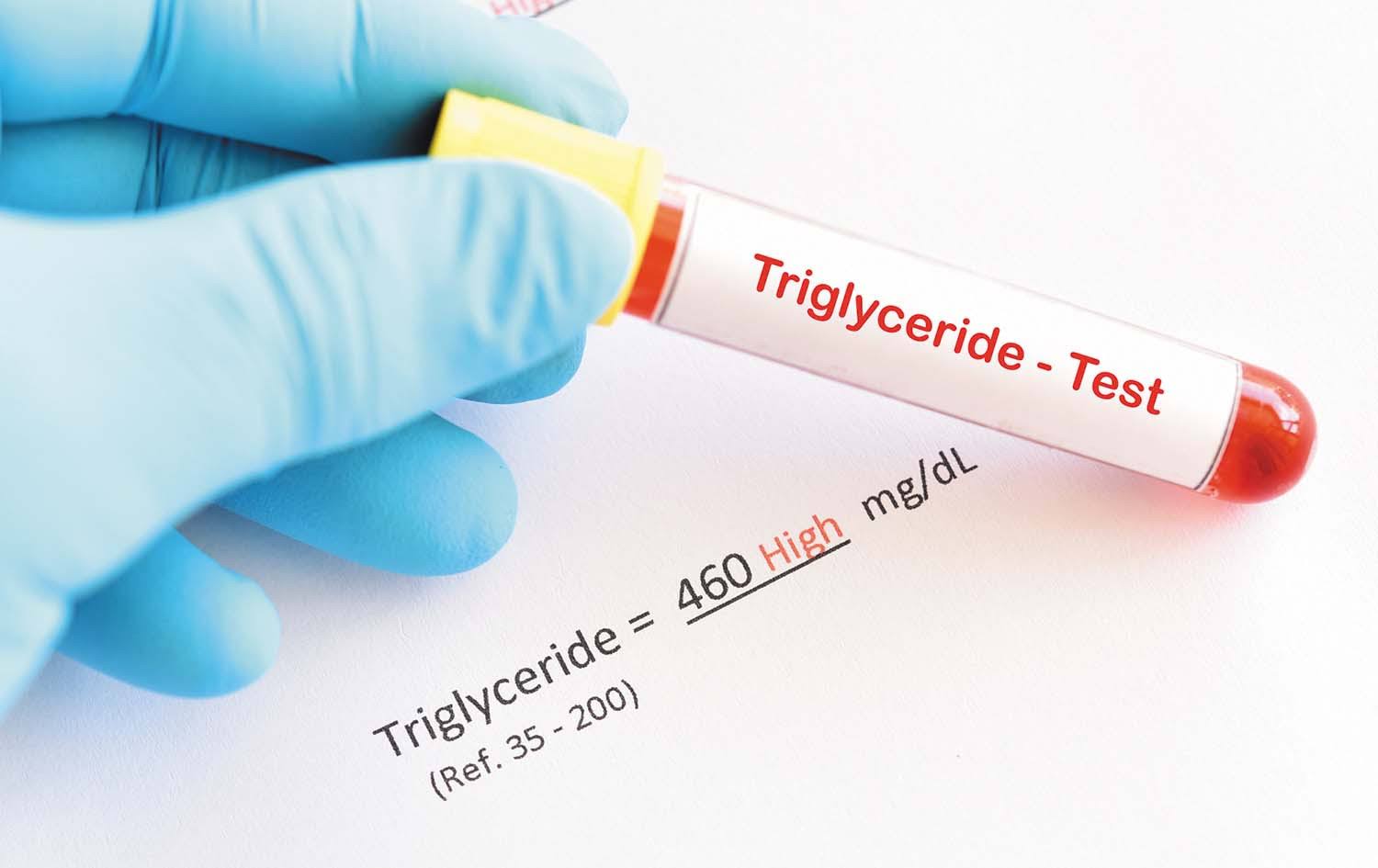TRIGLYCERIDE product image