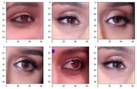 A Robust Framework for Real-Time Iris Landmarks Detection Using Deep  Learning