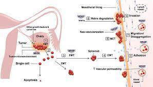 This forms the outermost layer of the ovary. A Proposed Model For Intraperitoneal Dissemination Of Ovarian Cancer Download Scientific Diagram
