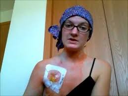 It stays underneath your skin, but there. Port Placement Surgery Youtube