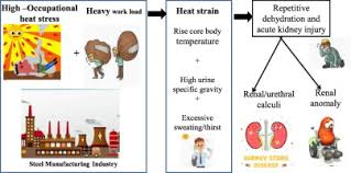 Risk Of Kidney Stone Among Workers Exposed To High Occupational Heat Stress A Case Study From Southern Indian Steel Industry Sciencedirect
