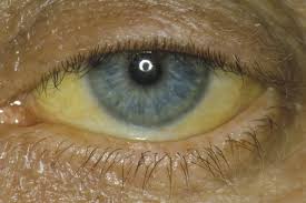 Gelbe Augen Med Kom