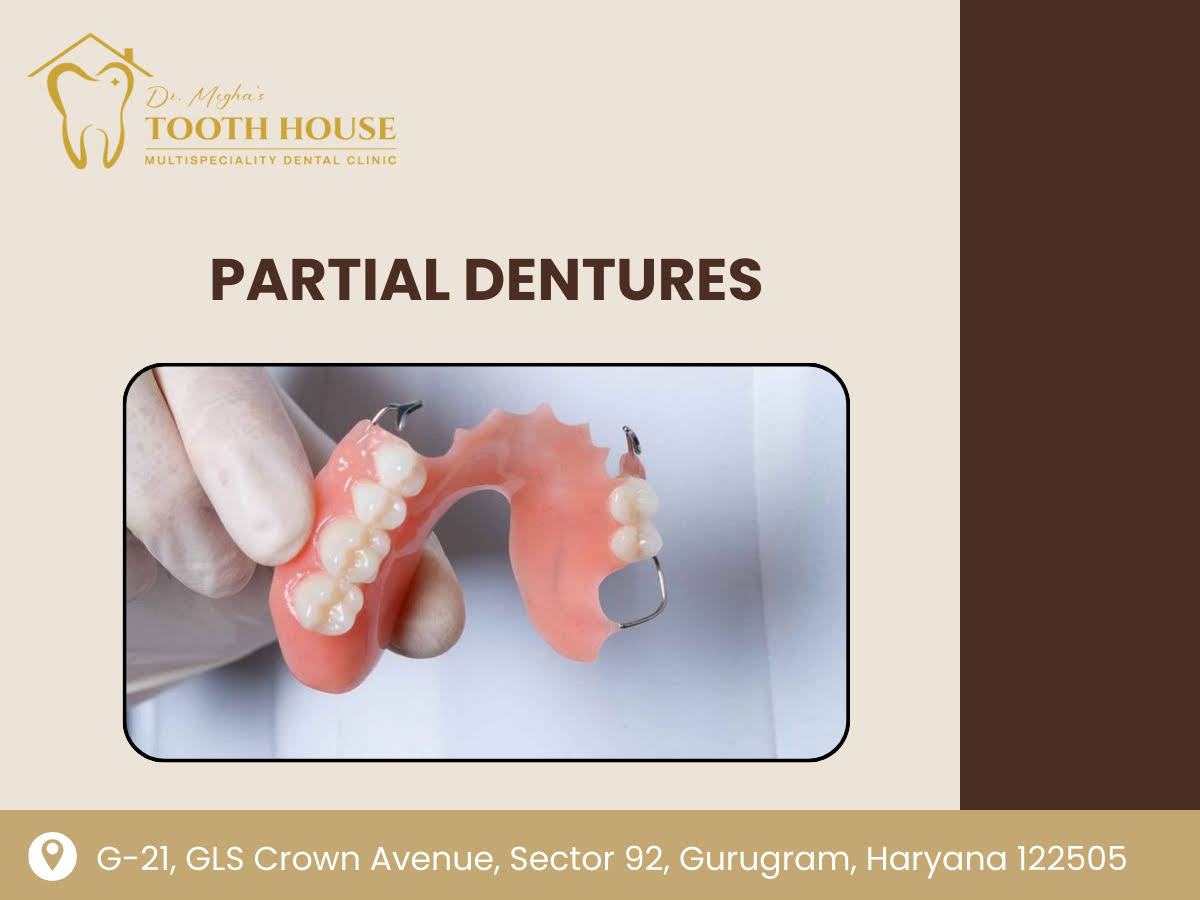 Partial Dentures product image