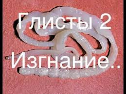 как избавиться от глистов у человека в домашних условиях Glisty 2 Izgnanie Kak Lechit Doma Luchshie Metody Lecheniya Doveryaj No Proveryaj Youtube V 2020 G Zdorove Zdorovoe Pitanie Zdorove I Krasota