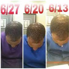 We dilligently believe in and want to share with the world a health message. Two Weeks Of Using The Beaucoup Hair Herbal Hair System Herbal Hair Grow Long Hair Hair System