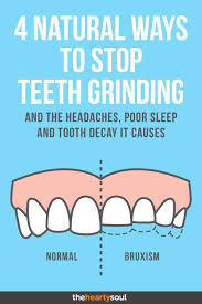 Are You Guilty Of Grinding Teeth Or Jaw Clenching You Could Have Bruxism The Technical Term For Teeth Grinding Keep Re Grinding Teeth Poor Sleep Tooth Decay