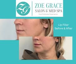 Zoe Grace Salon & Med Spa