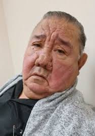 Ignacio Vigil, Jr. Obituary