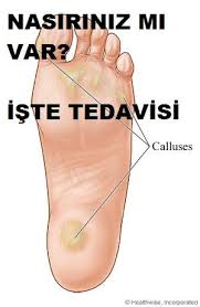 Vicks Nelere Iyi Gelir Saglik Saglikli Yasam Tarzi Dogal Saglik