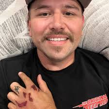 Does anyone know why there were so many dead fish in the lake Sunday?