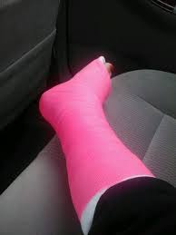 My First Cast The Bright Pink Is Pretty Leg Cast Broken Leg It Cast