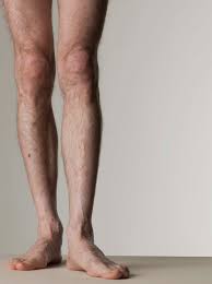 How Men Can Lose Leg Fat Quickly