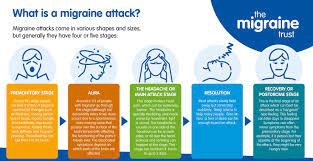 Most migraines last from 30 minutes to several hours. Symptoms And Stages The Migraine Trust