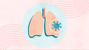 Image result for Pneumonia