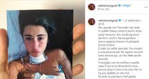 Social indignati per la frase della vignali. Valentina Vignali Tornare A Vivere Dopo La Malattia