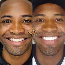 Sorrisos e Sonrisitas. (@sorrisosesonrisitas) · Instagram 照片和视频