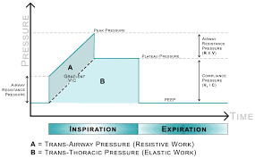 The other factor in compliance of the lung is surfactant. Demystifying Advanced Concepts In Mechanical Ventilation Acp Hospitalist