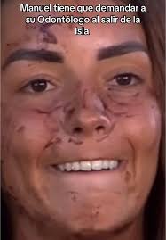 Serpiente Anita Y Manuel