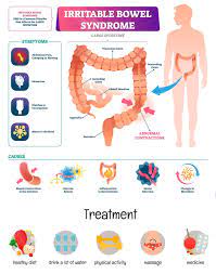 I am 57 years old. Are You Overlooking Symptoms Of Irritable Bowel Gi Associates