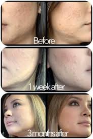 Shu Uemura Los Angeles, CA