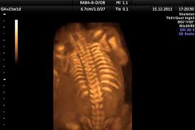 sonogram vs ultrasound difference and comparison diffen