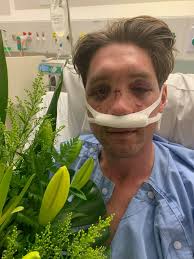 In June 2023, I was involved in a forced landing near Derby, resulting in  injuries to my face.