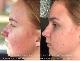Teresa Caudill Partnered/ Rodan + Fields Skincare