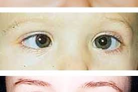 This is the first time in last 6 months that my eyes are coming back to normal thanks to allah almighty and dr. Knowledgebase Ranu Eye Specialist In Puchong