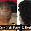 In order to grow natural black hair, trim your ends if you had permed hair previously. 3