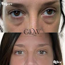 Brandy Bloom, Fnp-Bc ᴀᴇꜱᴛʜᴇᴛɪᴄꜱ ɪɴᴊᴇᴄᴛᴏʀ