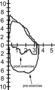 Image result for Exercise Spirometry