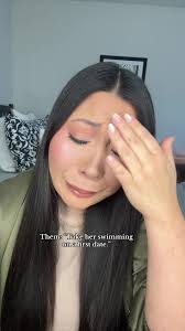 Embracing Birthmarks: Confidence in Uniqueness