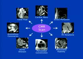 Image result for Cardiac MRI