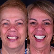 Meet Fernanda! She is part of our Welcome committee in Dentology! A  bilingual CSR, that can help you provide information about any treatment  that you may be interested in and schedule your