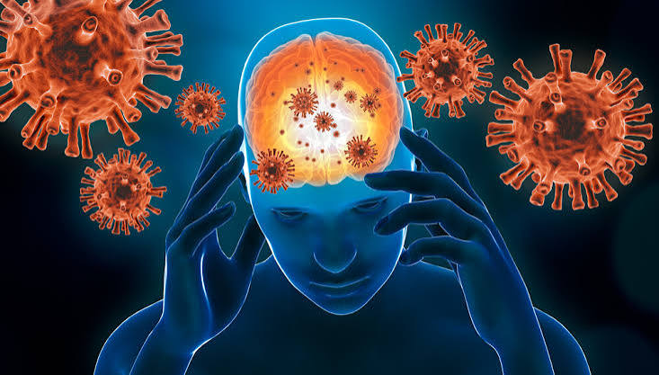 Meningite Viral: O Que &Eacute;, Sintomas, Transmiss&atilde;o e Tratamento