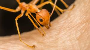 Baking soda's antibacterial properties will help keep the bites clean, but this natural substance can also soothe itching. Fire Ant Bite Treatment How To Treat A Painful Fire Ant Bite