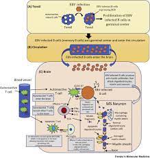 Пцр крови на вэб в киеве. Epstein Barr Virus In Multiple Sclerosis Theory And Emerging Immunotherapies Trends In Molecular Medicine