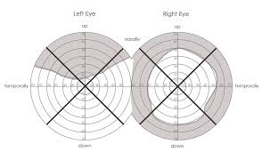 Military Disability Ratings For Eye Conditions