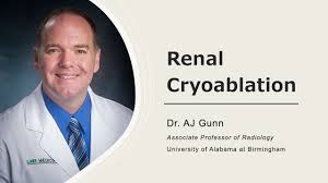 Renal Cryoablation