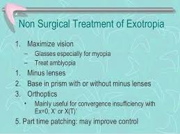 13 Exotropia